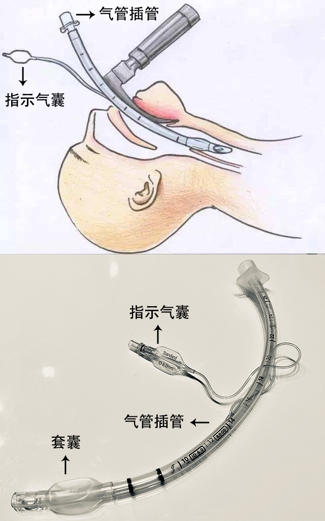 贊?。?！250萬指示氣囊，客戶100%滿意！